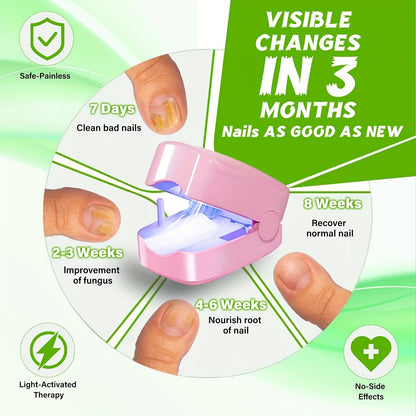🦶Fungal infection laser treatment device